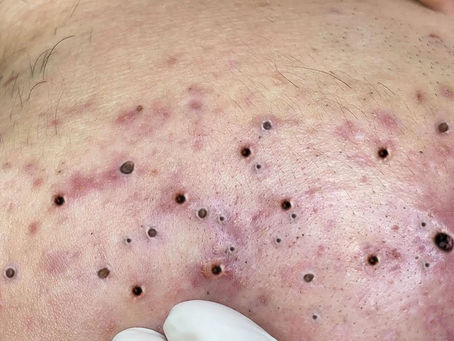 Click Photo below to watch video