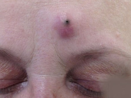 Click Photo below to watch video