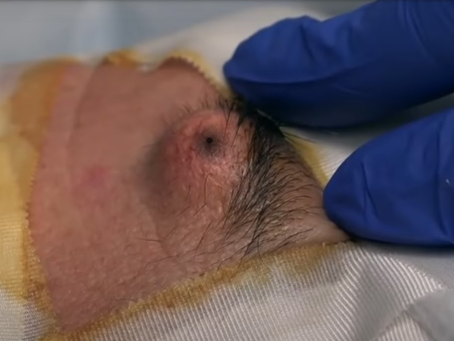 Click Photo below to watch video