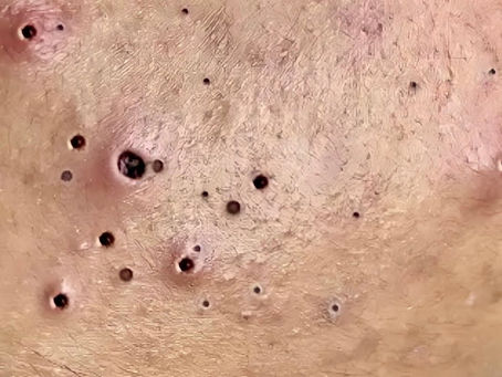 Click Photo below to watch video