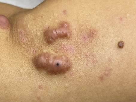 Click Photo below to watch video