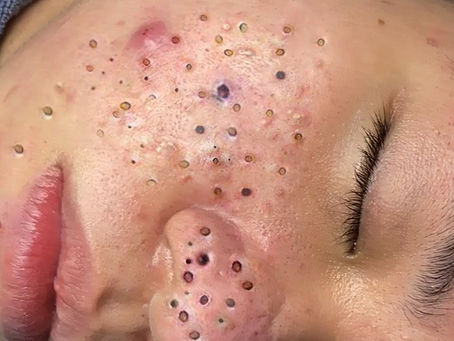 Click Photo below to watch video