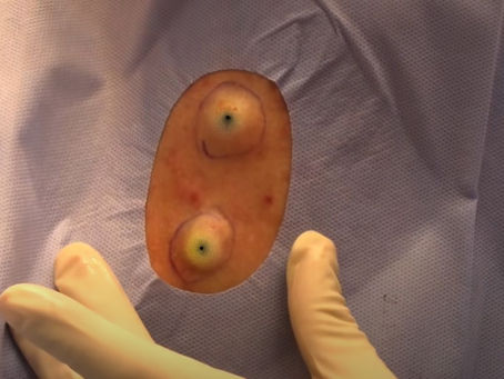 Click Photo below to watch video