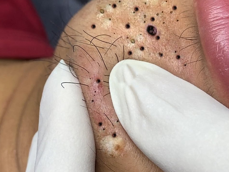 Click Photo below to watch video