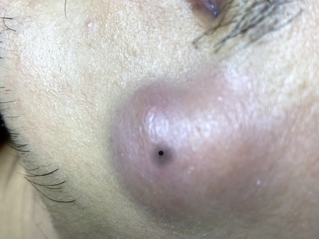 Click Photo below to watch video