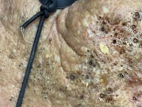 Click Photo below to watch video