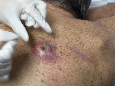 Click Photo below to watch video