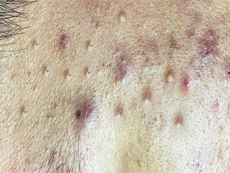 Click Photo below to watch video