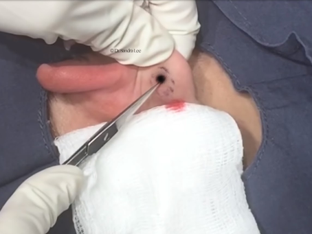 Click Photo below to watch video