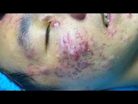 Click Photo below to watch video