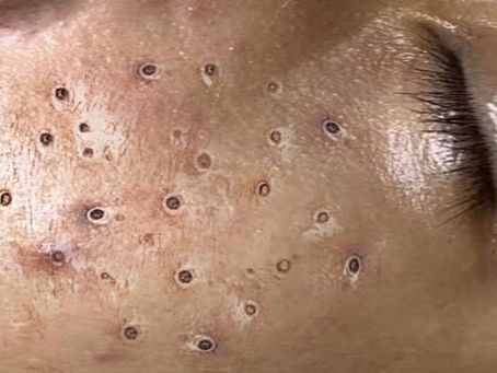 Click Photo below to watch video