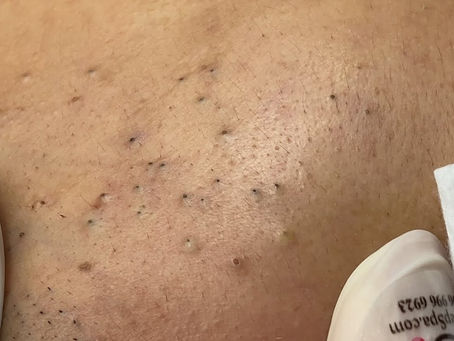 Click Photo below to watch video