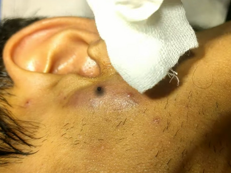 Click Photo below to watch video