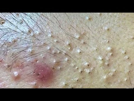 Click Photo below to watch video