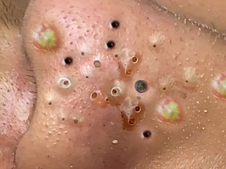 Click Photo below to watch video