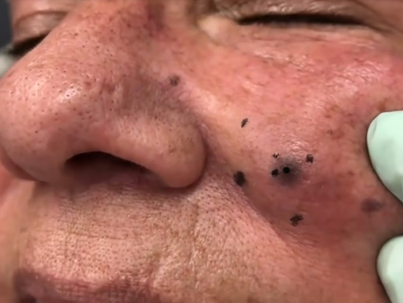 Click Photo below to watch video