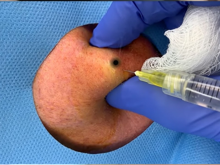 Click Photo below to watch video