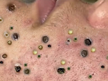 Click Photo below to watch video