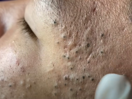 Click Photo below to watch video