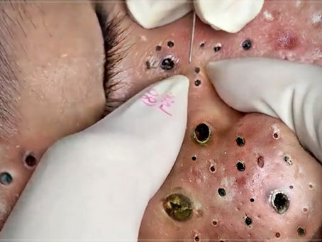 Click Photo below to watch video