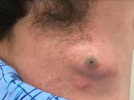 Click Photo below to watch video