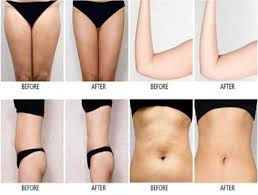 before and after.jpeg