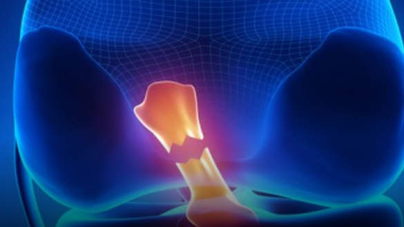 Nanotecnología para reemplazar ligamentos sin dolor