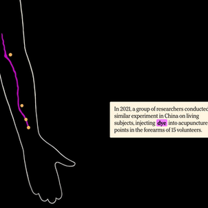 Graphic from the article above, showing dye (pink)traveling along the PC meridian on an arm. Points PC 3, 4, 5, and 6 are in yellow.