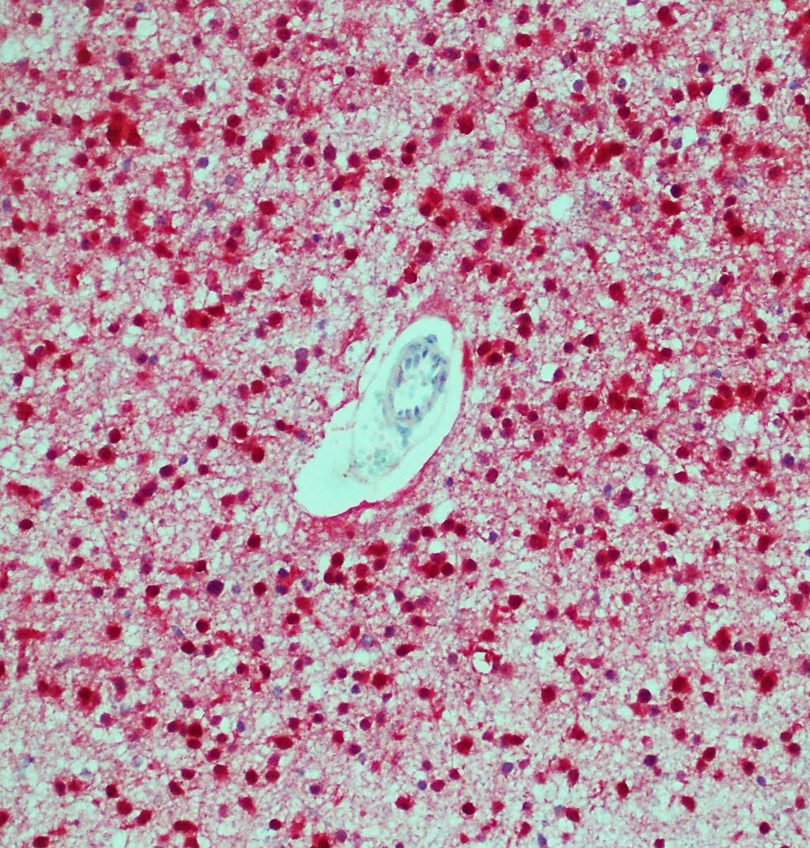 Anti-IDH1 R132H (clone QM002)