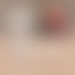 Pulmão itinerante visita a RMC e alerta sobre os perigos do cigarro