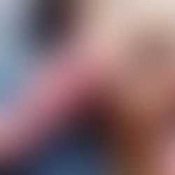 Cárie inicial: entenda quando começa e como identificar