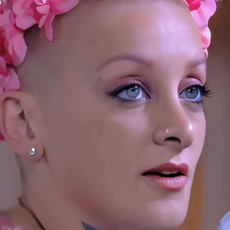 Participante do Big Brother Argentino descobre que está com leucemia: entenda o câncer que afeta as células sanguíneas