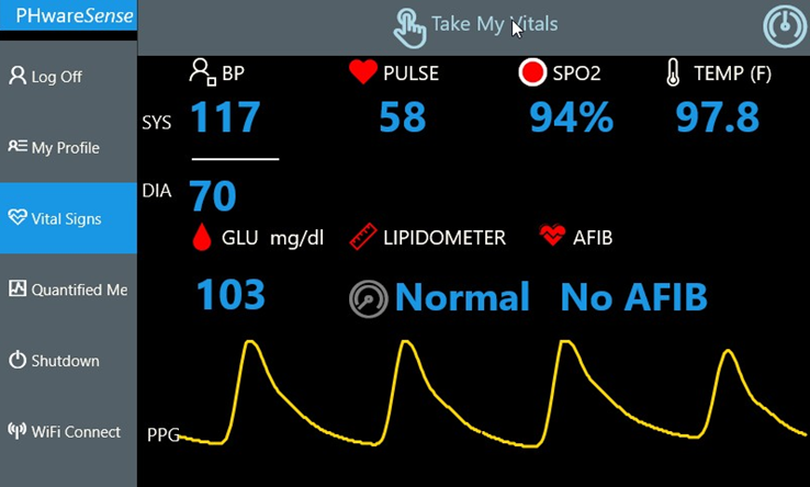 Vital Sign - SPO2 What is my normal?