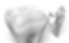 dental treatment