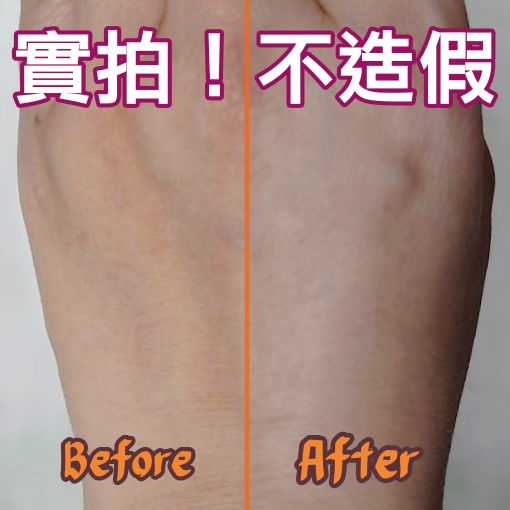 Thumbnail: 手背實拍BA圖