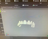 Santamaria Protesis Dental CAD CAM