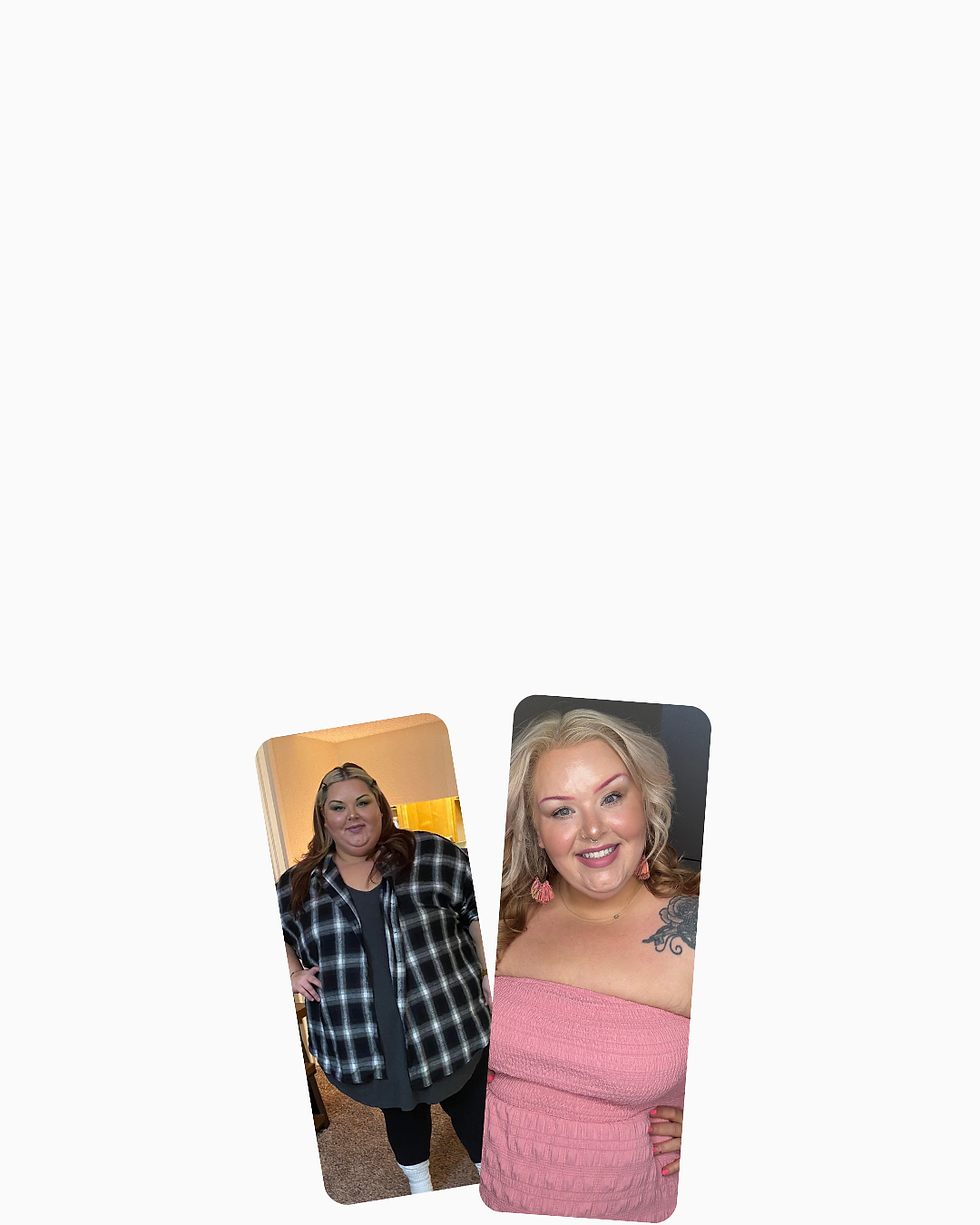 Emerge Weight Loss Transformation Stories