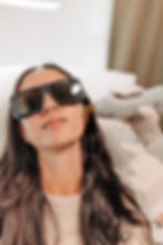 Laser skin tightening treatment using Candela GentleMax pro