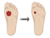 wound healing (1).png