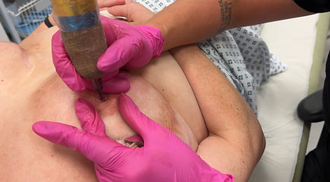 NHS nurse training session - areola tattoo