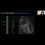 Thumbnail: *EP for the NP & PA On-Demand Program