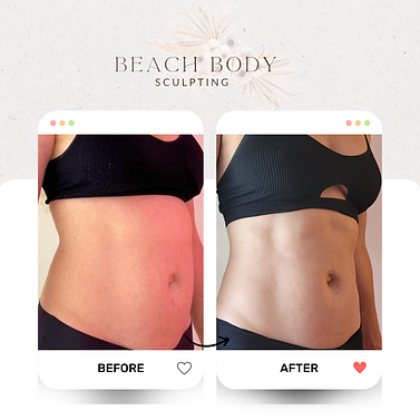 laser lipo fat reducting treatment results