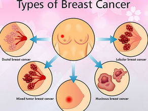 There Are Many Different Kinds of Breast Cancer