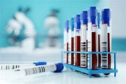 What Does YOUR BLOOD Test Revel?