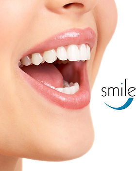 Ortodoncia Invisalign