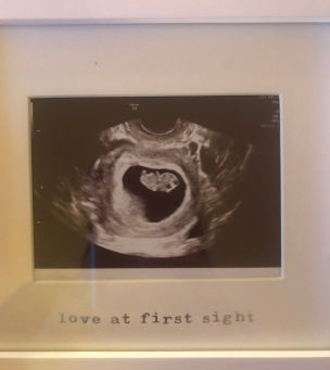 23 Weeks & 6 Days – The Day Our Plans Changed Forever
