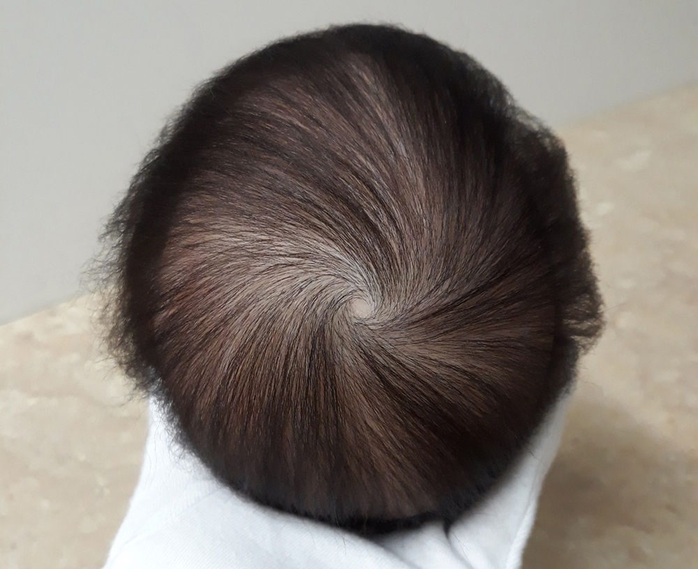 つむじフェチ リボーンドールの植毛にて