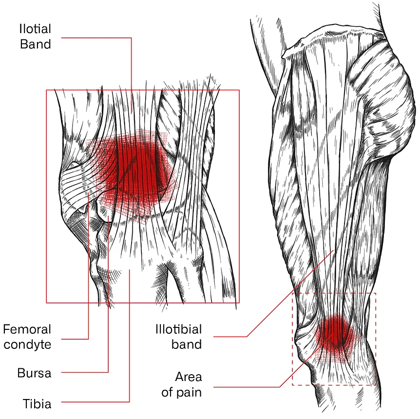 knee_anatomy_full_edited.png