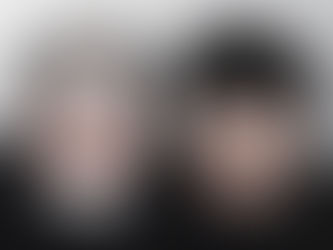 엠자탈모와 정수리탈모 자연스러운 밀도 보강 사례