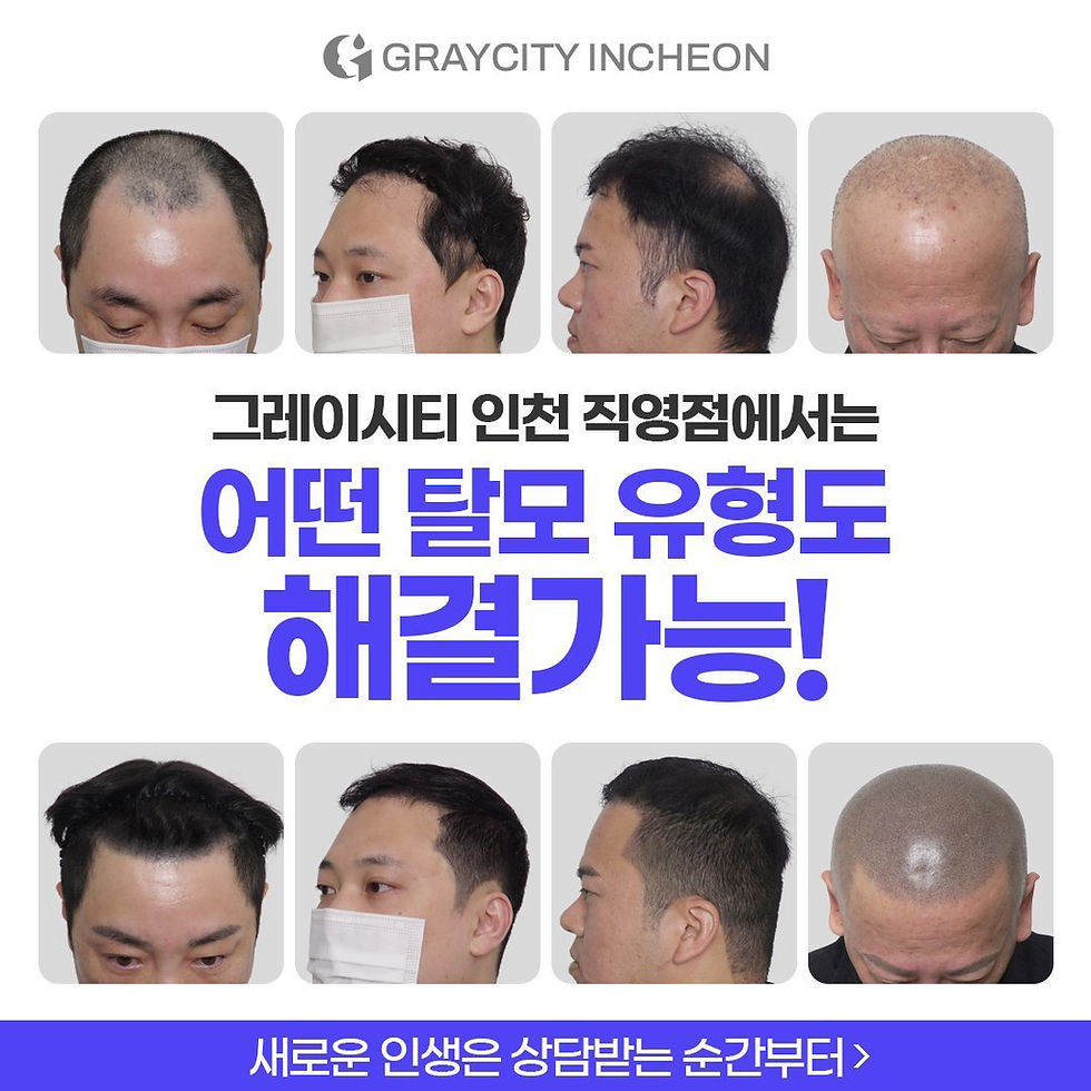 인천 두피문신
